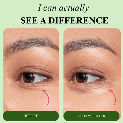 Bio-Collagen Aloe Vera Eye Patches