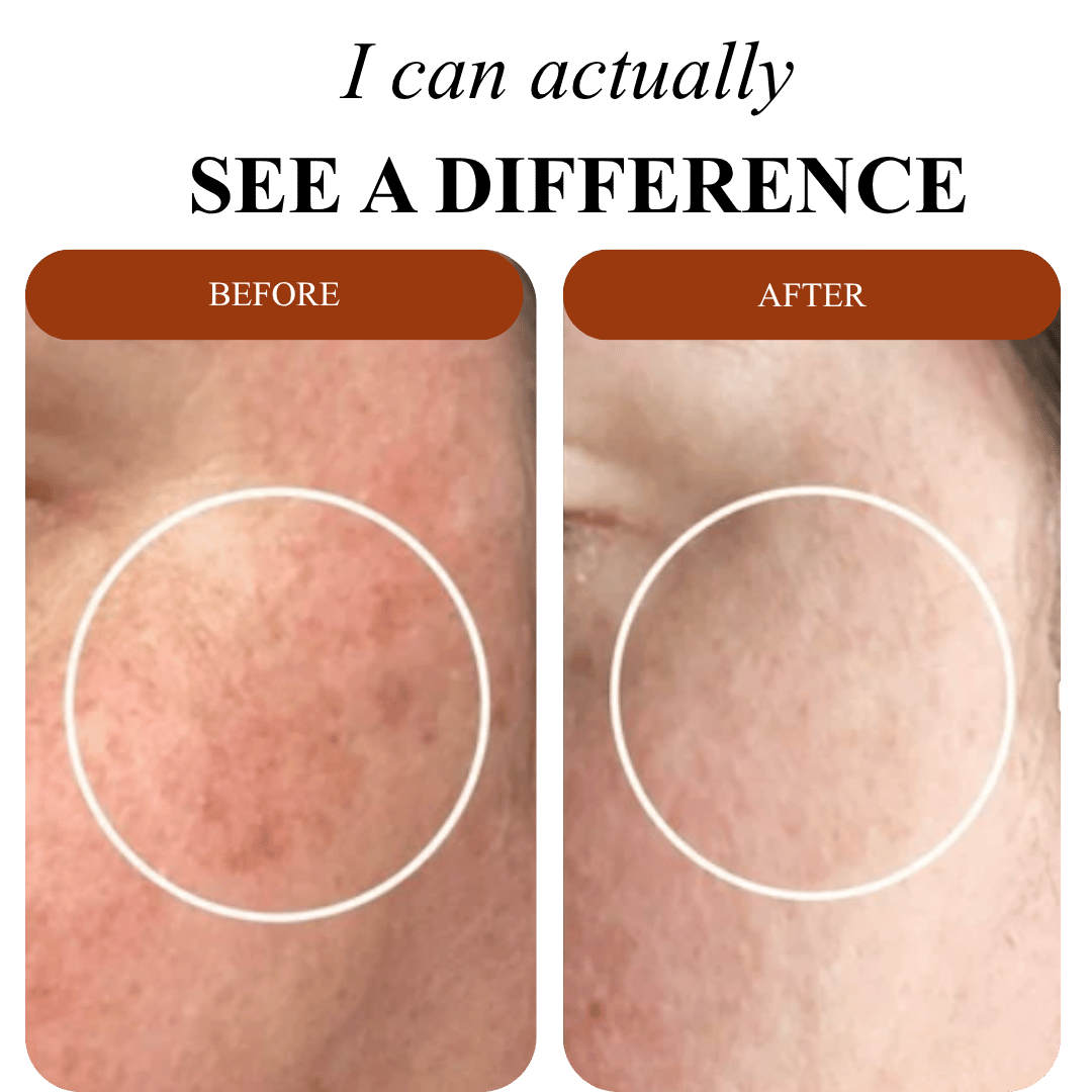 Peel Shot Glow Rice Ampoule Duo™