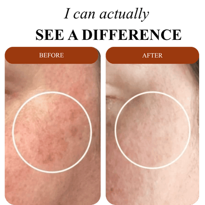 Peel Shot Glow Rice Ampoule Duo™