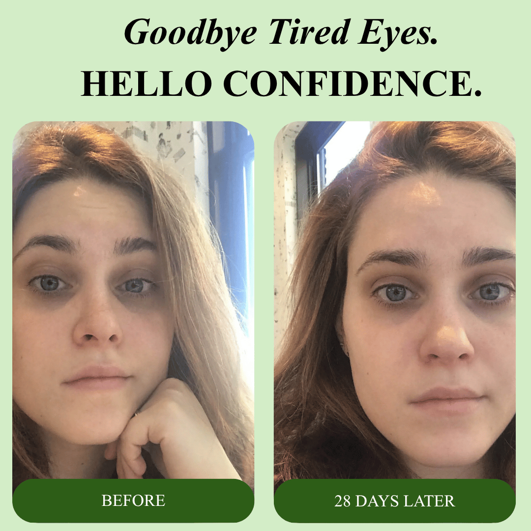 Bio-Collagen Aloe Vera Eye Patches