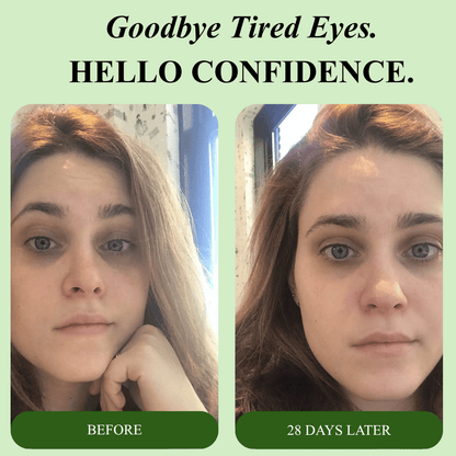 Bio-Collagen Aloe Vera Eye Patches