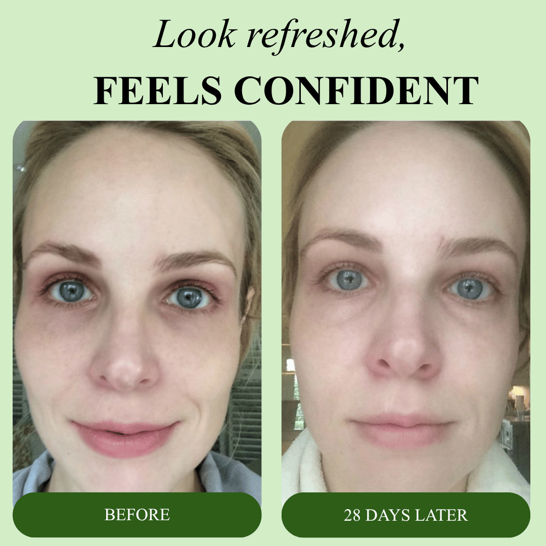 Bio-Collagen Aloe Vera Eye Patches