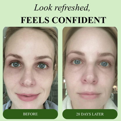 Bio-Collagen Aloe Vera Eye Patches