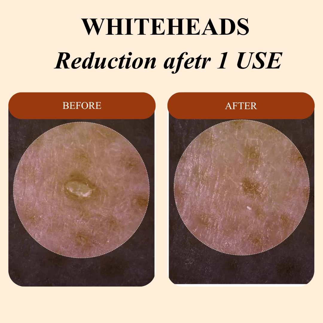 Peel Shot Glow Rice Ampoule Duo™