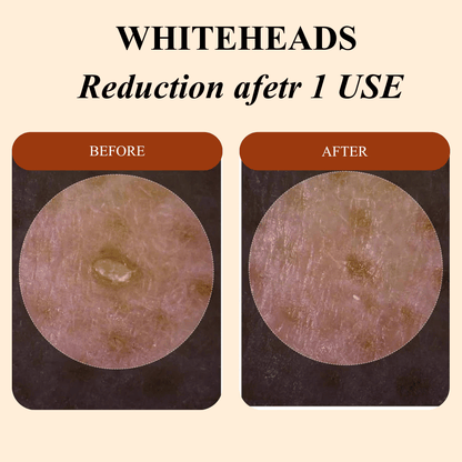 Peel Shot Glow Rice Ampoule Duo™